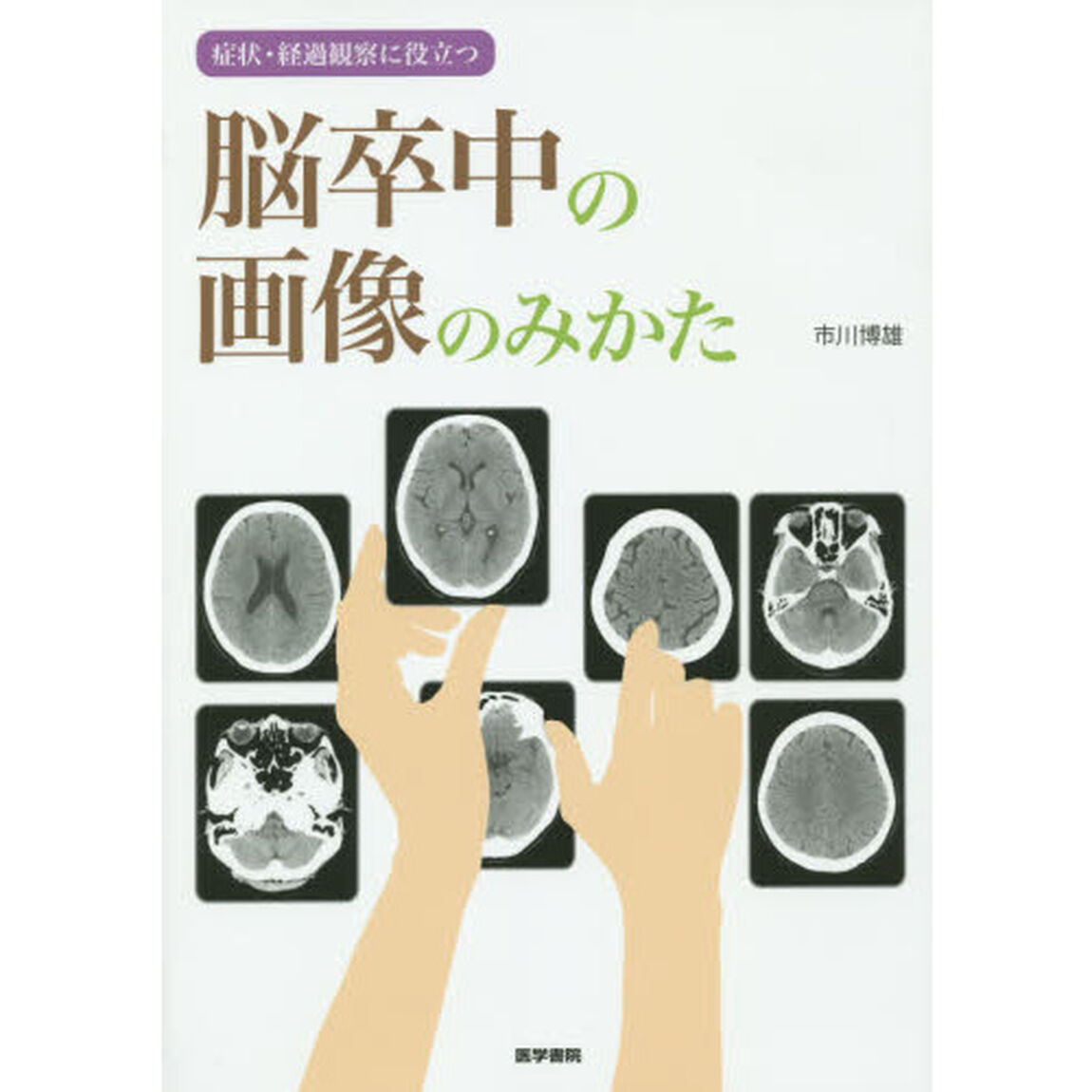 脳卒中の画像のみかた　症状・経過観察に役立つ