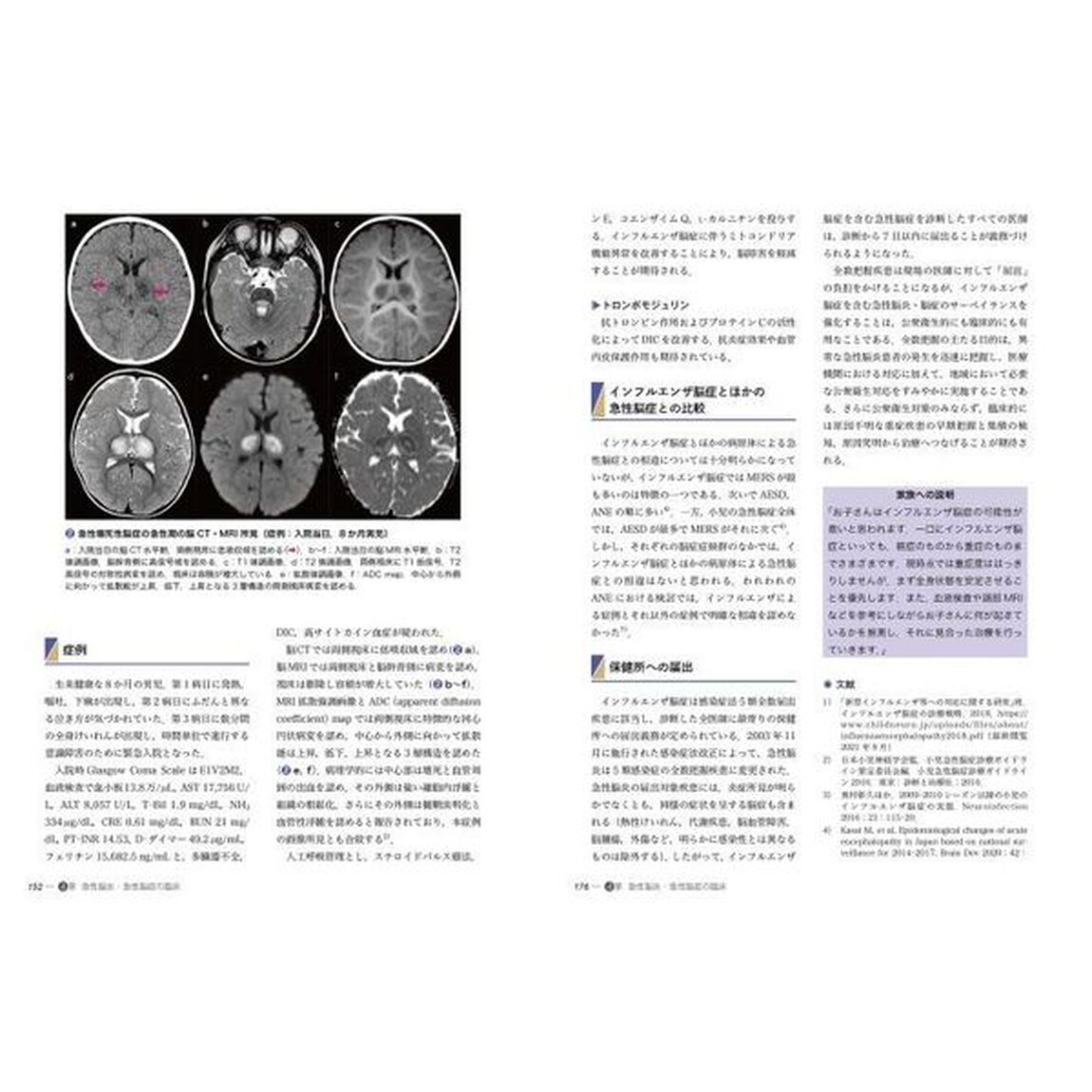 小児急性脳炎・脳症のとらえ方と治療戦略　Ｐｒａｃｔｉｃｅ　ａｎｄ　Ｐｒｏｇｒｅｓｓ