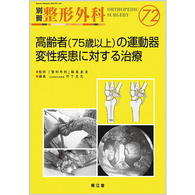 高齢者〈７５歳以上〉の運動器変性疾患に対する治療