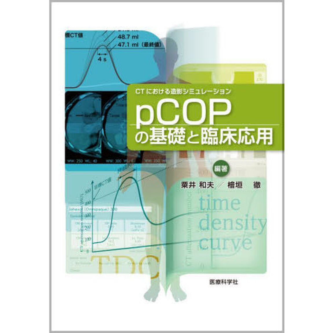 ｐＣＯＰの基礎と臨床応用　ＣＴにおける造影シミュレーション