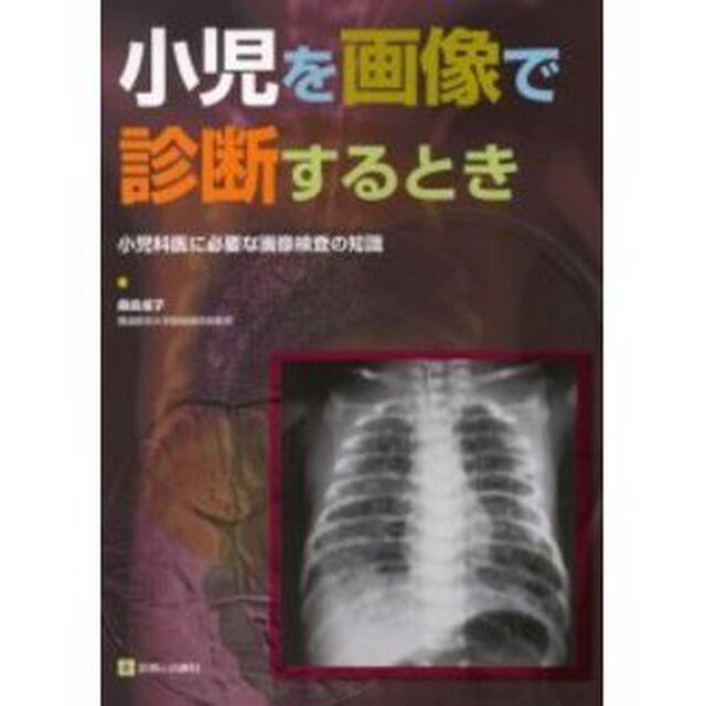 小児を画像で診断するとき「小児科医に必要な画像検査の知識」