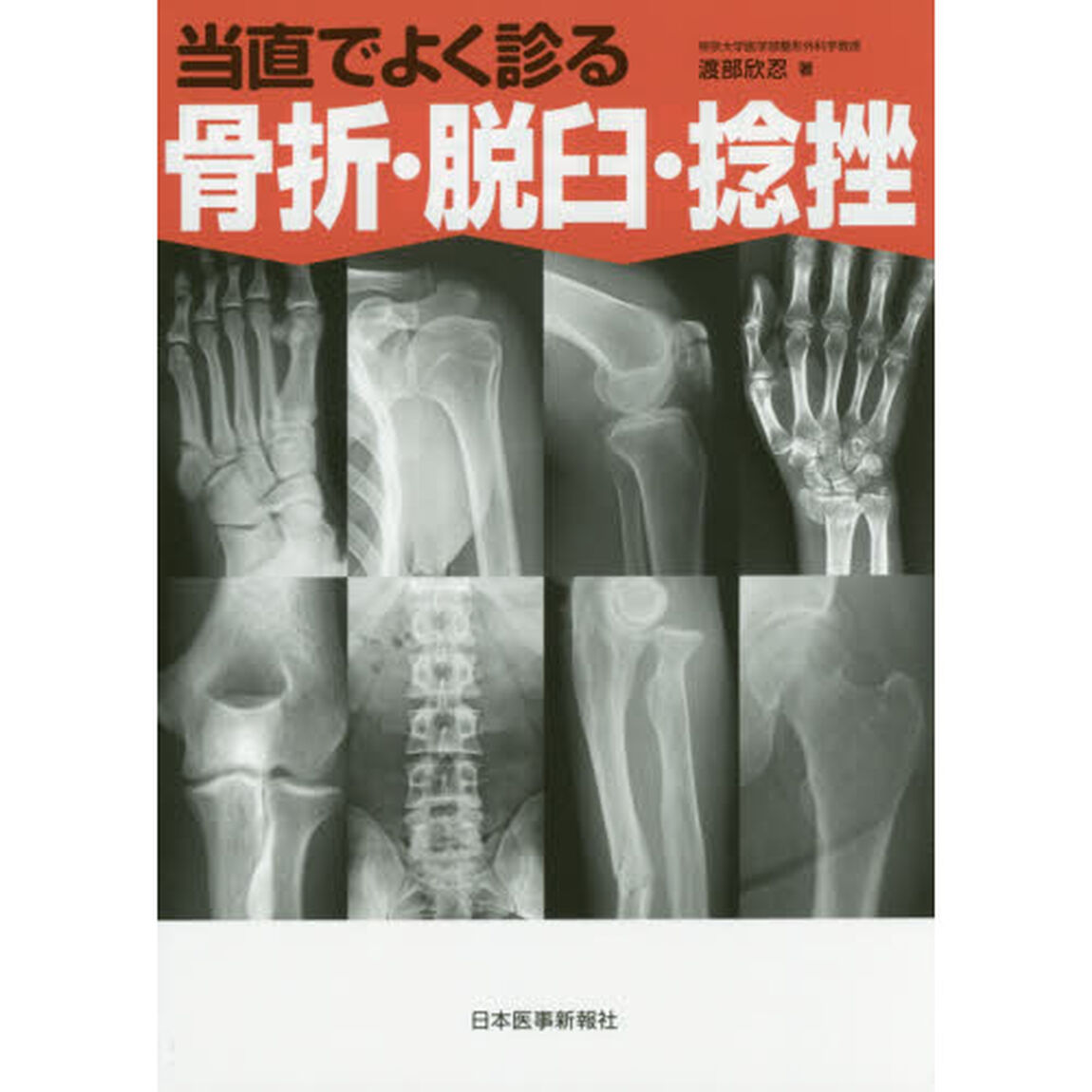 当直でよく診る骨折・脱臼・捻挫