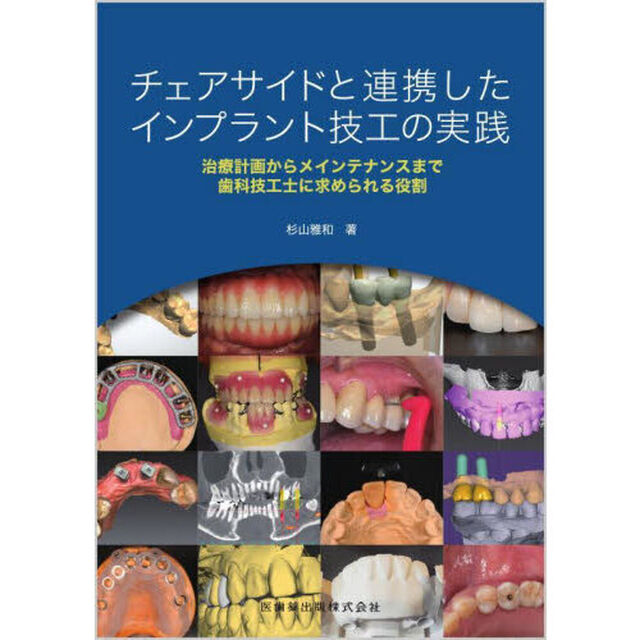 チェアサイドと連携したインプラント技工の実践　治療計画からメインテナンスまで歯科技工士に求められる役割