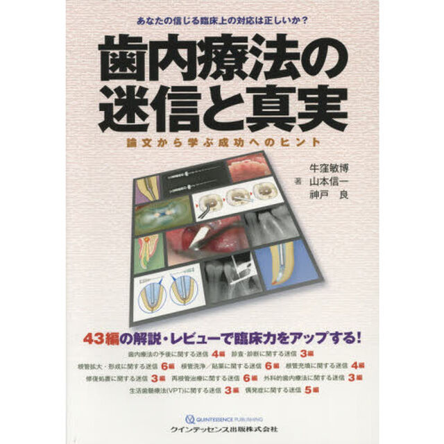 歯内療法の迷信と真実　論文から学ぶ成功へのヒント