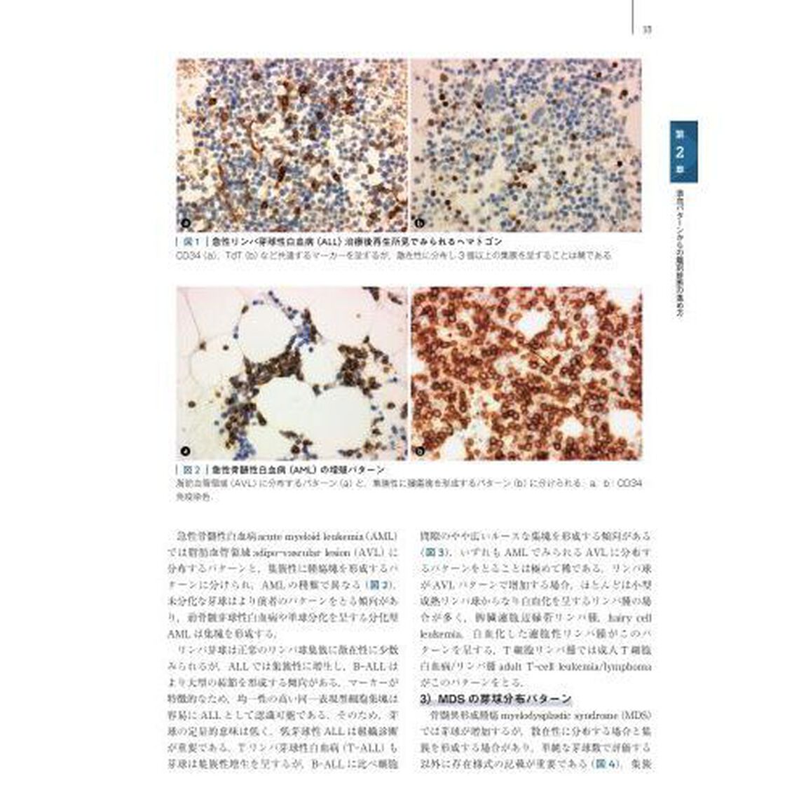 骨髄組織病理学　骨髄標本の見方と考え方