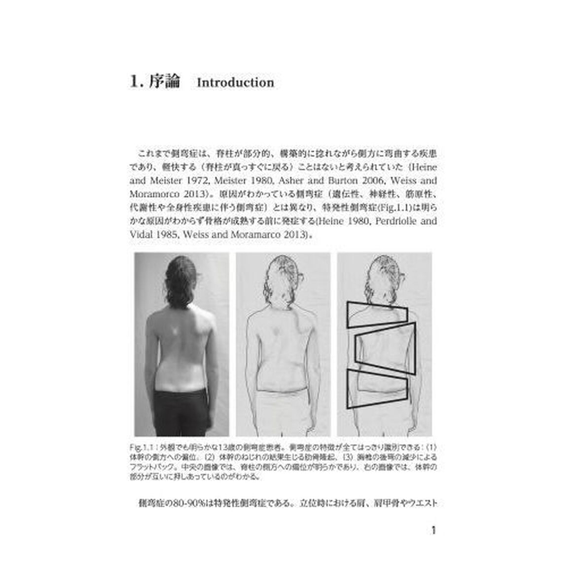シュロスセラピー　最新のシュロス法による側弯症の保存療法〈運動療法・装具療法〉