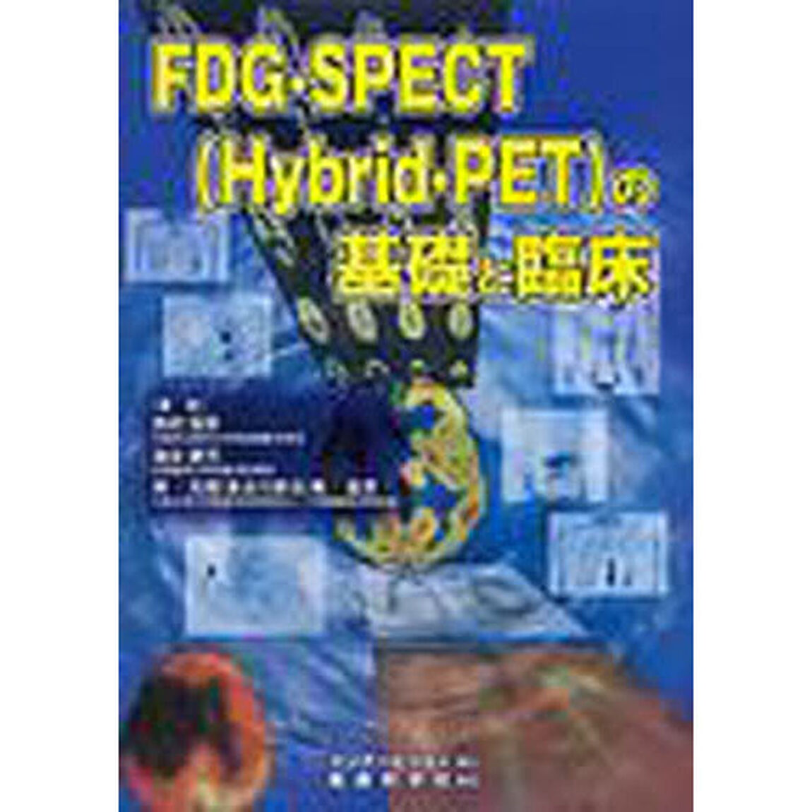 ＦＤＧ－ＳＰＥＣＴ〈Ｈｙｂｒｉｄ‐ＰＥＴ〉の基礎と臨床