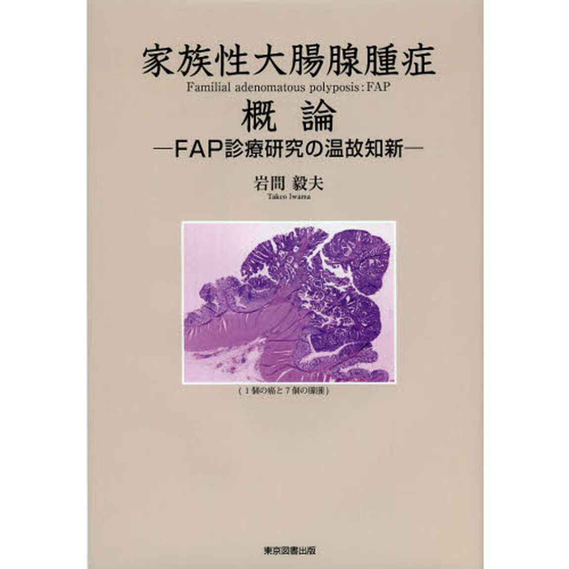家族性大腸腺腫症概論　ＦＡＰ診療研究の温故知新