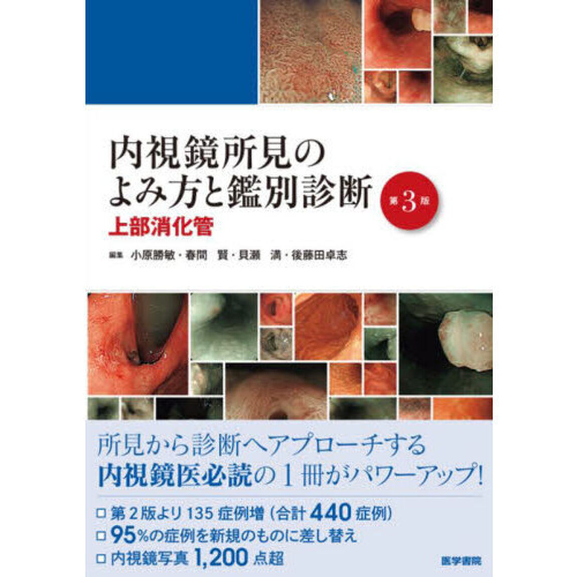 内視鏡所見のよみ方と鑑別診断　上部消化管「第３版」
