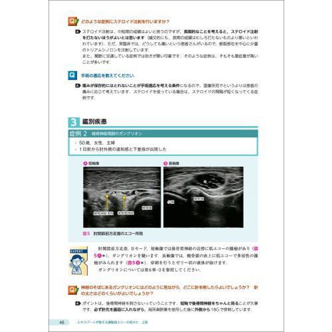 エキスパートが教える運動器エコーの見かた　診療の鍵となる着眼点と所見の解釈　上肢