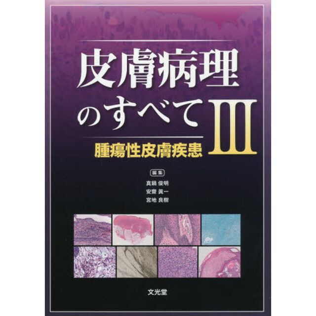 皮膚病理のすべて　３「腫瘍性皮膚疾患」