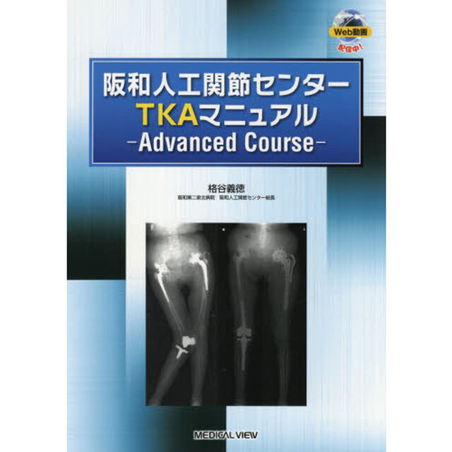 阪和人工関節センターＴＫＡマニュアル　Ａｄｖａｎｃｅｄ　Ｃｏｕｒｓｅ