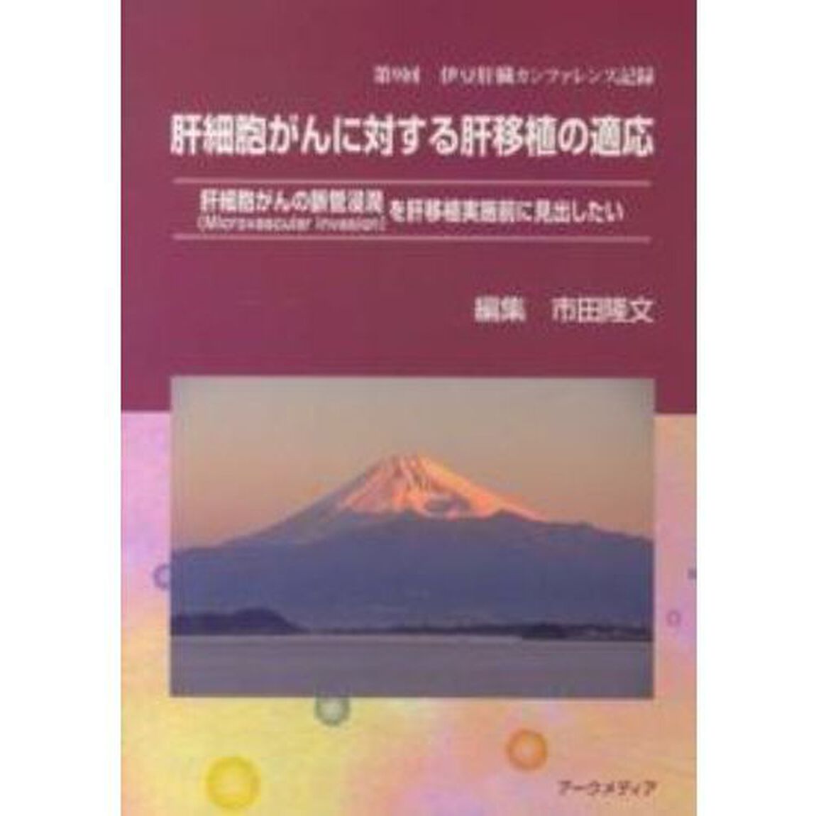 肝細胞がんに対する肝移植の適応