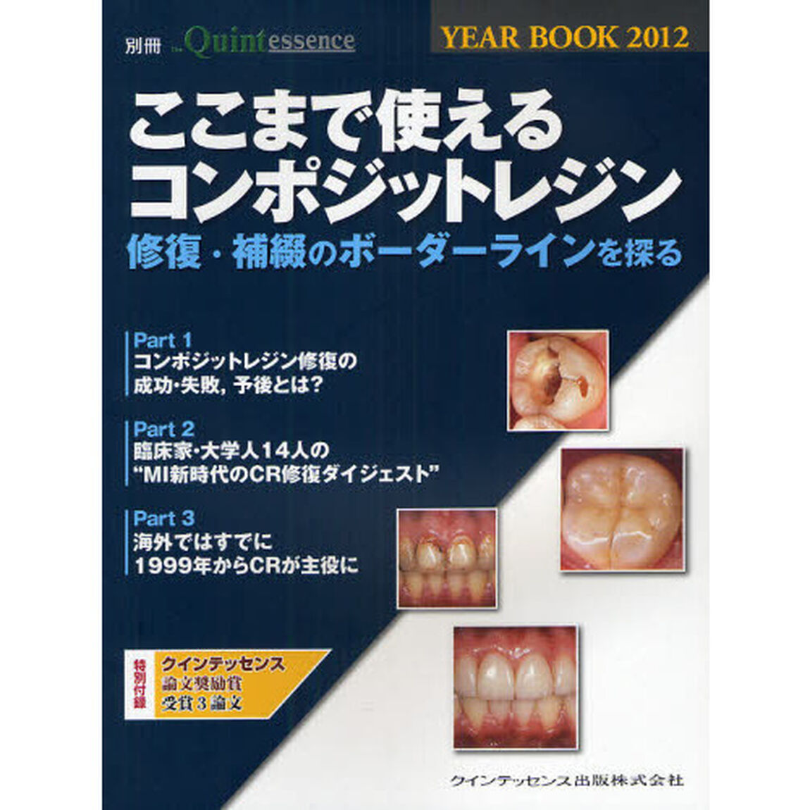ＹＥＡＲ　ＢＯＯＫ　２０１２「ここまで使えるコンポジットレジン　修復・補綴のボーダーラインを探る」