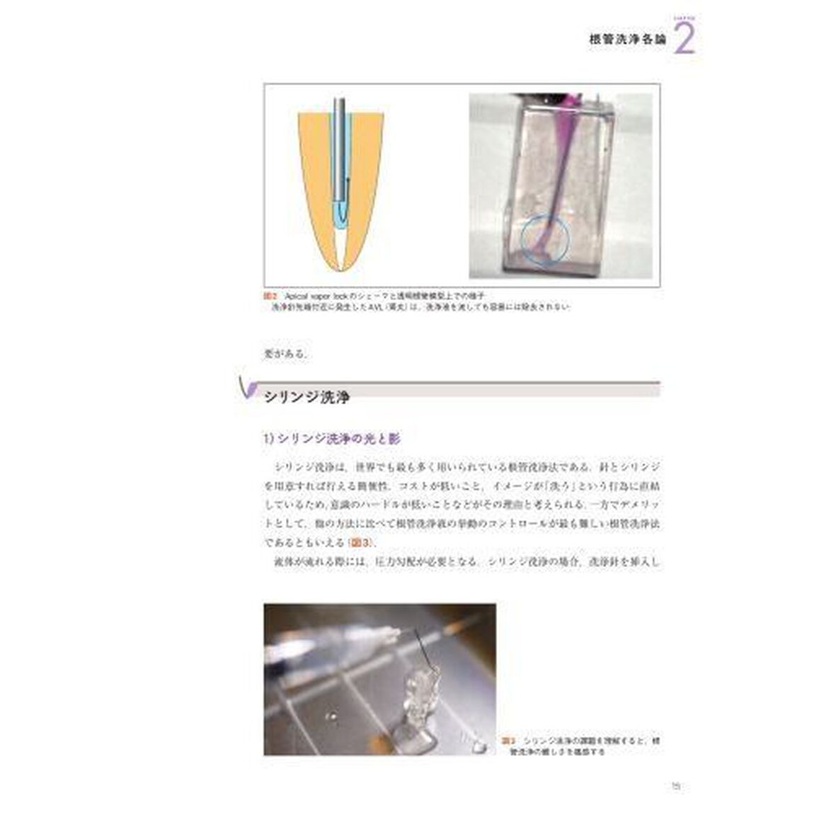 根管洗浄