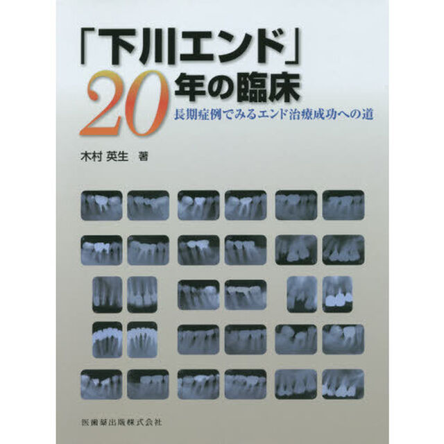 「下川エンド」２０年の臨床　長期症例でみるエンド治療成功への道