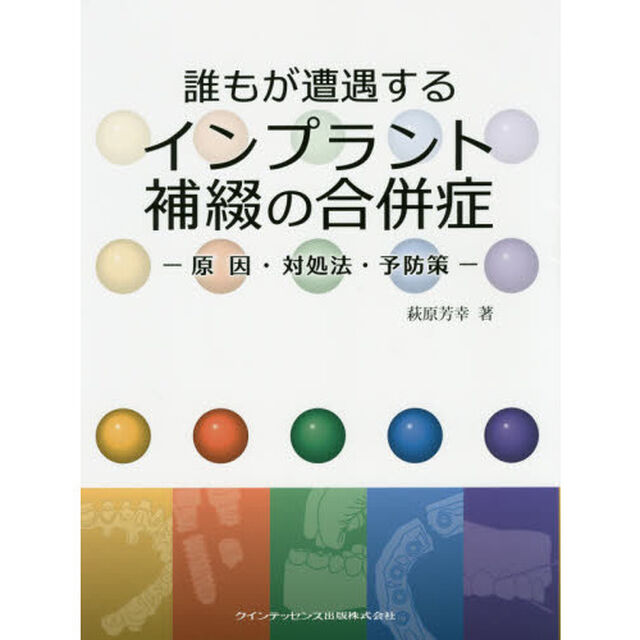 誰もが遭遇するインプラント補綴の合併症　原因・対処法・予防策