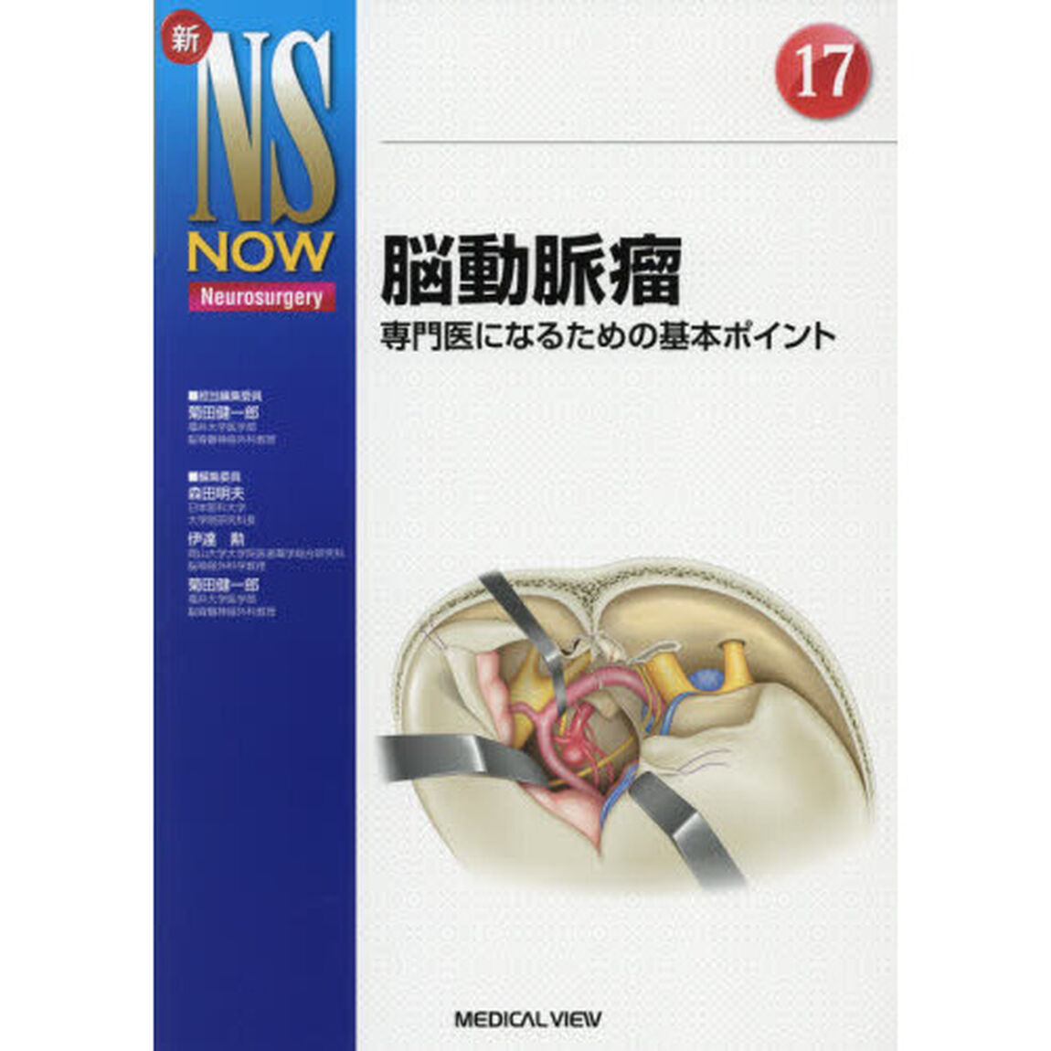 脳動脈瘤　専門医になるための基本ポイント