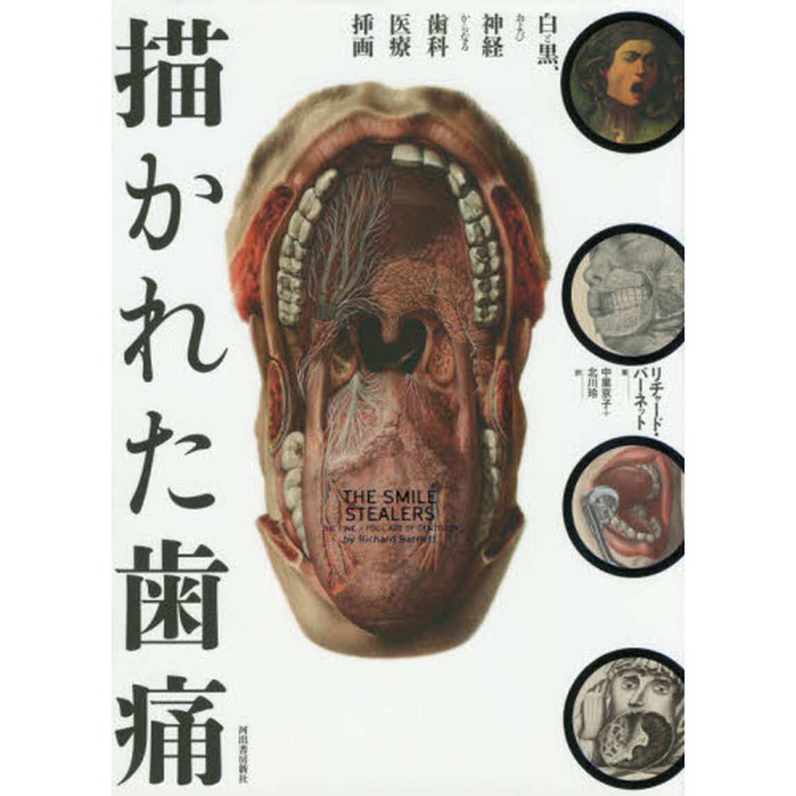 描かれた歯痛　白と黒、および神経からなる歯科医療挿画
