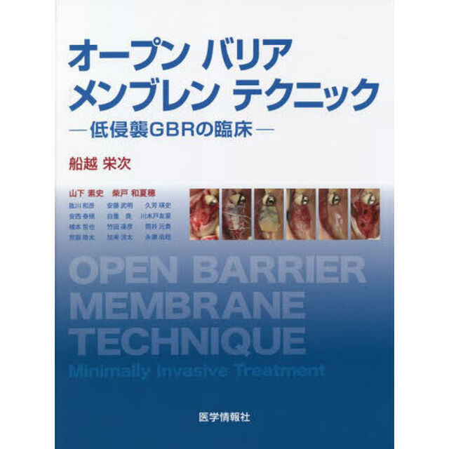 オープンバリアメンブレンテクニック　低侵襲ＧＢＲの臨床