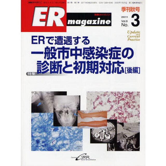 ＥＲマガジン　Ｖｏｌ．８Ｎｏ．３（２０１１Ａｕｔｕｍｎ）「特集ＥＲで遭遇する一般市中感染症の診断と初期対応　後編」