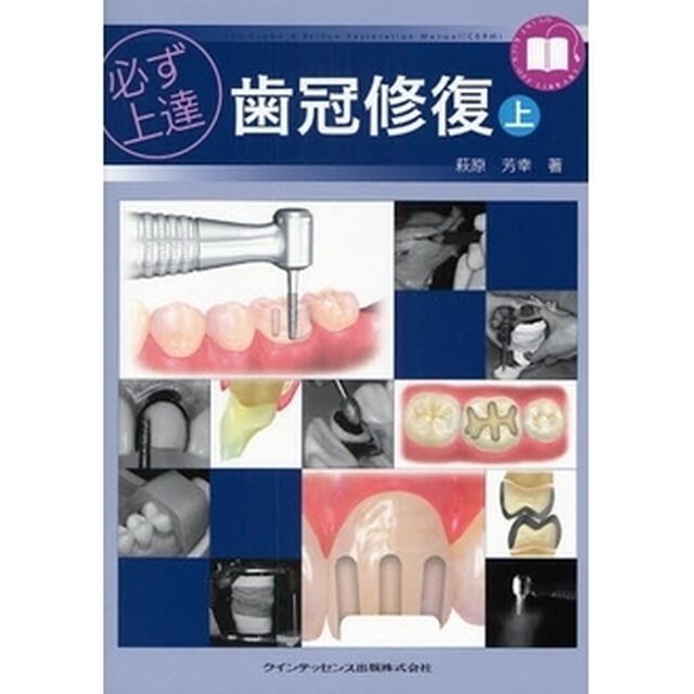 必ず上達歯冠修復　上