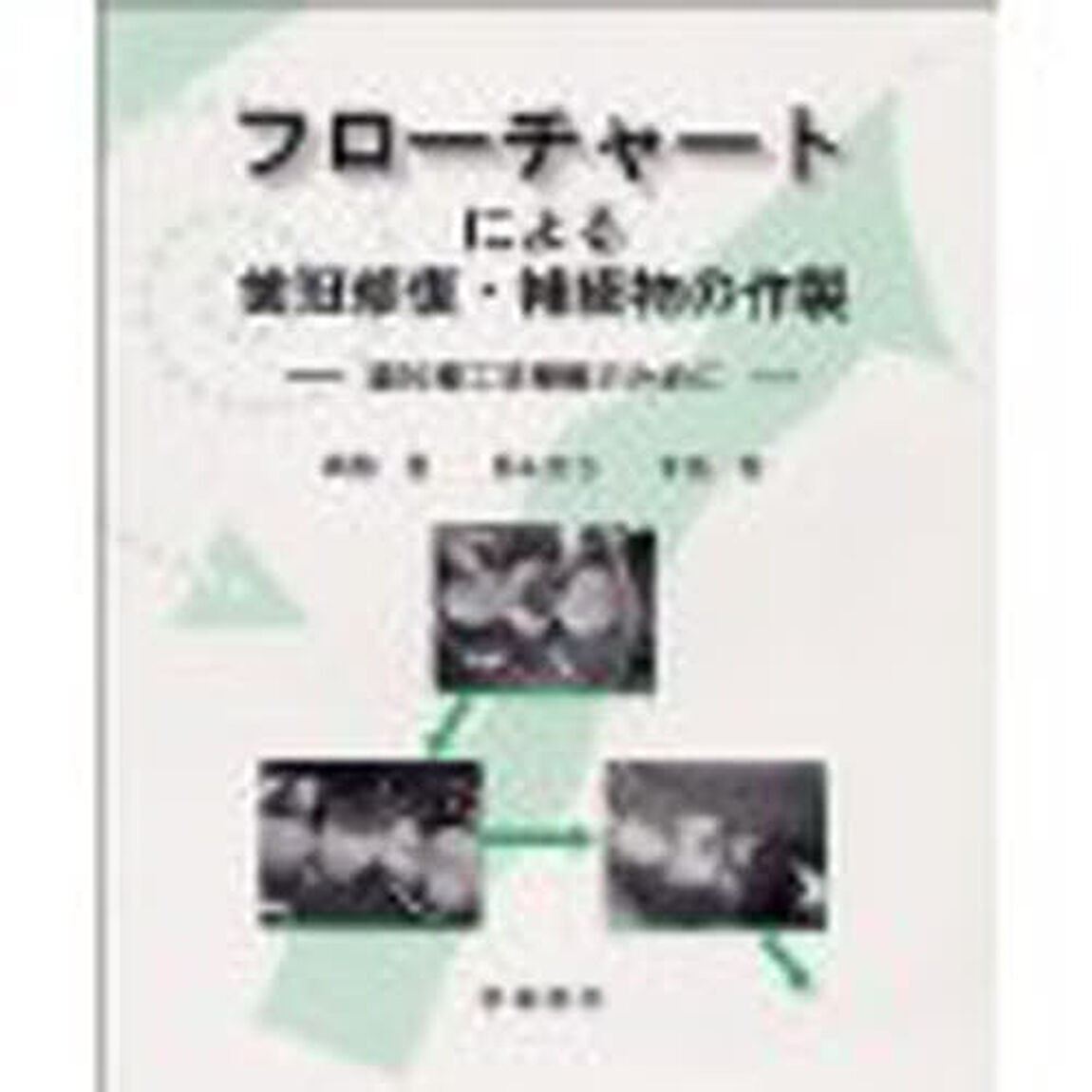 フローチャートによる歯冠修復・補綴物の作