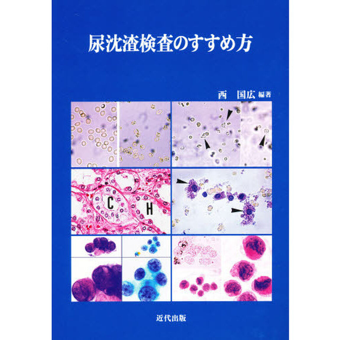 尿沈【サ】検査のすすめ方　「尿沈【サ】検査法」の標準化に向けて