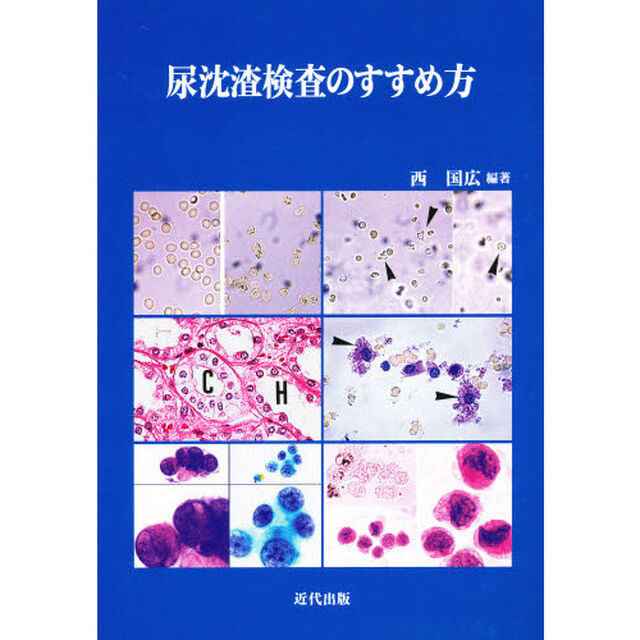 尿沈【サ】検査のすすめ方　「尿沈【サ】検査法」の標準化に向けて