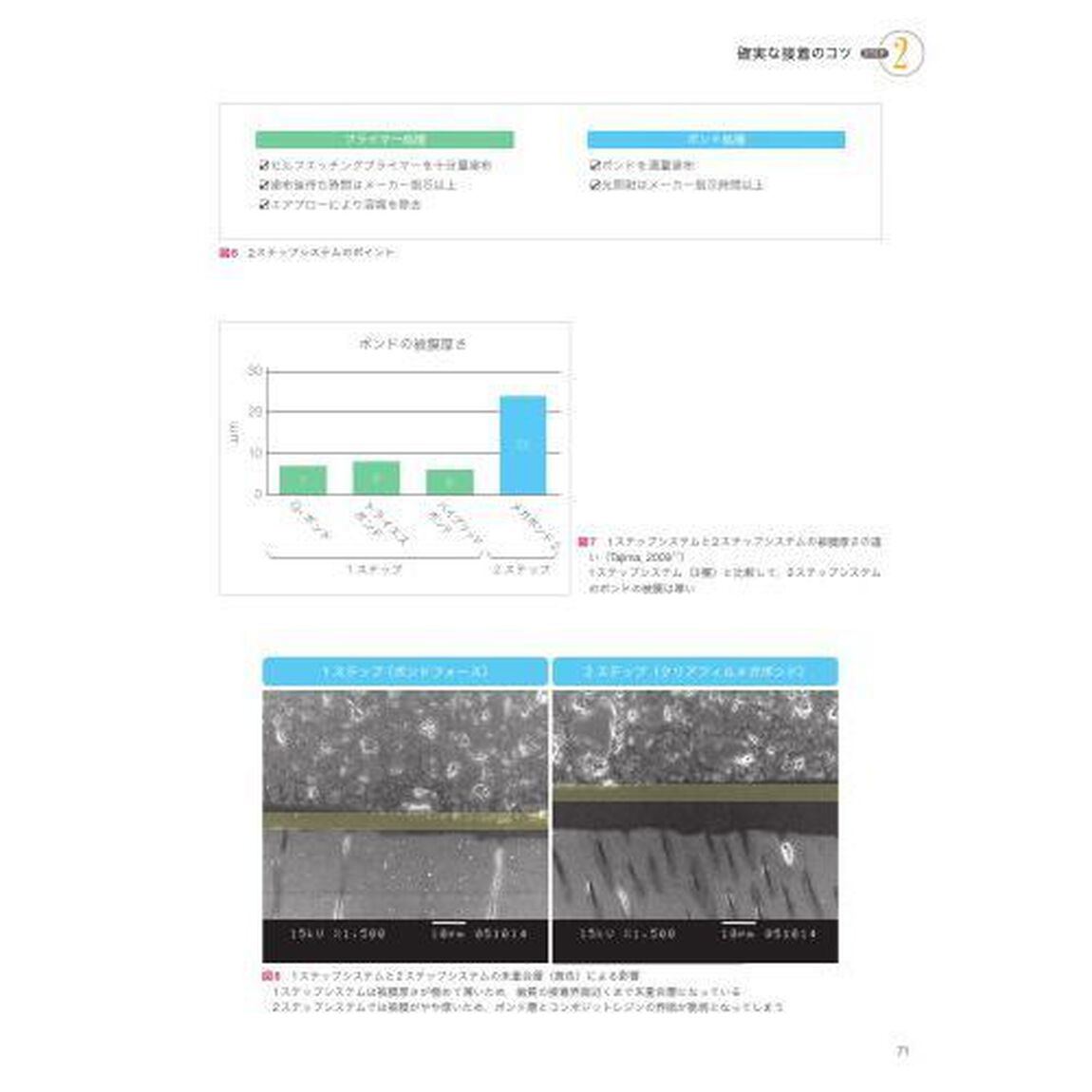 手に取るようにわかるコンポジットレジン修復のメソッド