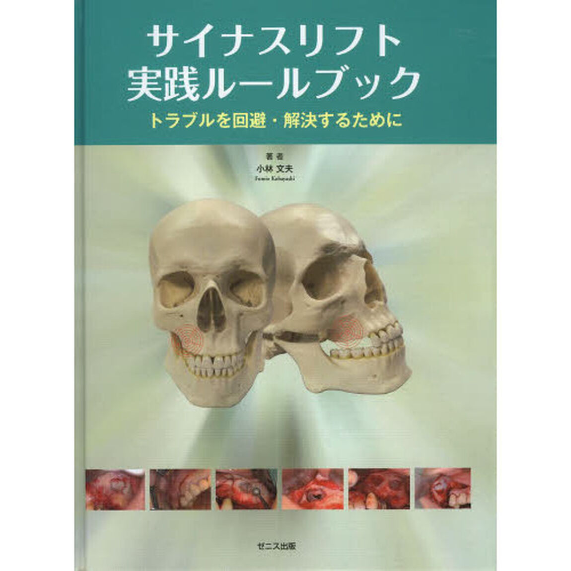 サイナスリフト実践ルールブック
