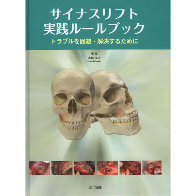 サイナスリフト実践ルールブック