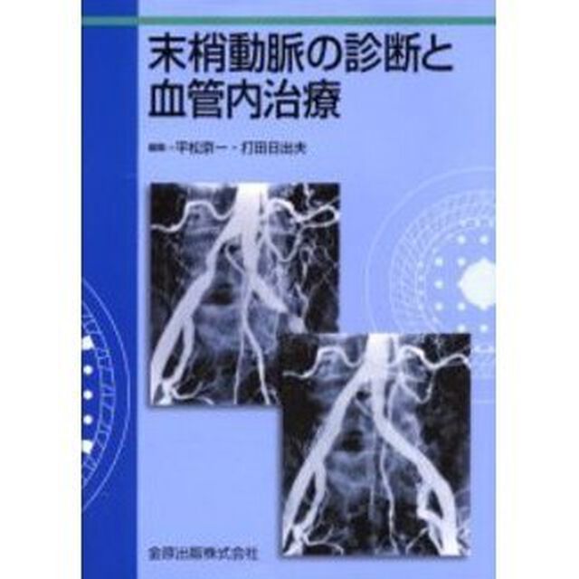末梢動脈の診断と血管内治療