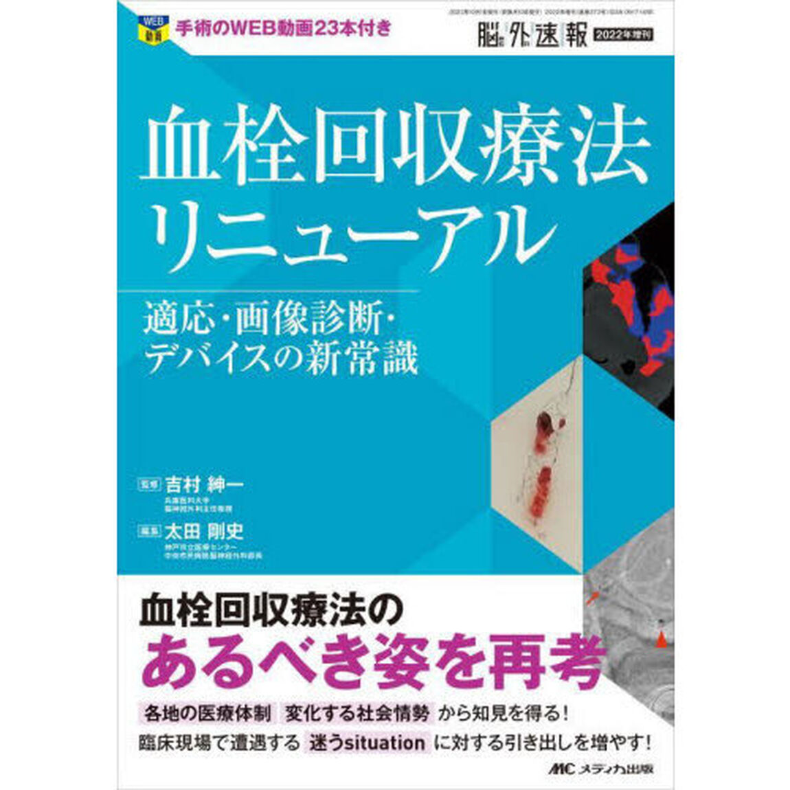 血栓回収療法リニューアル　適応・画像診断・デバイスの新常識