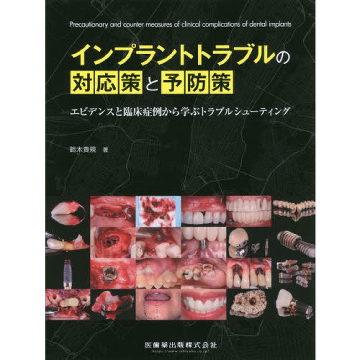 インプラントトラブルの対応策と予防策　エビデンスと臨床症例から学ぶトラブルシューティング