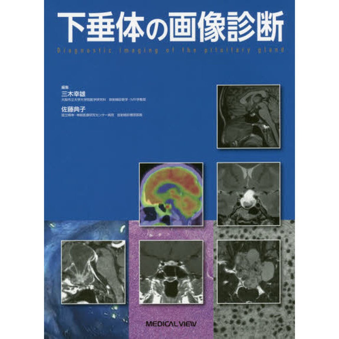 下垂体の画像診断