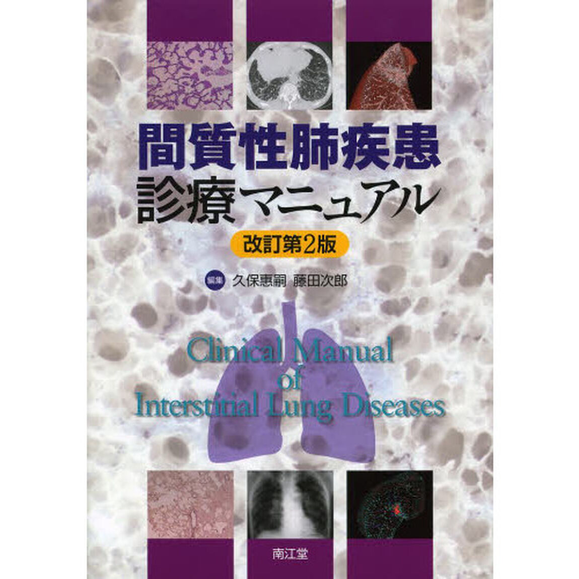 間質性肺疾患診療マニュアル「改訂第２版」