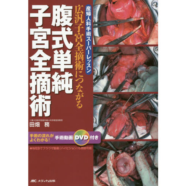 腹式単純子宮全摘術　広汎子宮全摘術につながる