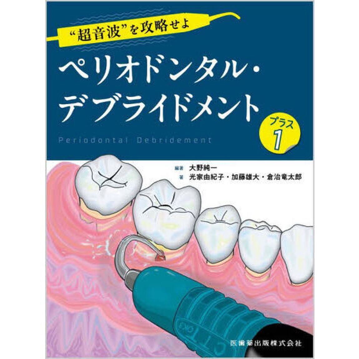 &ldquo;超音波&rdquo;を攻略せよペリオドンタル・デブライドメント　プラス１