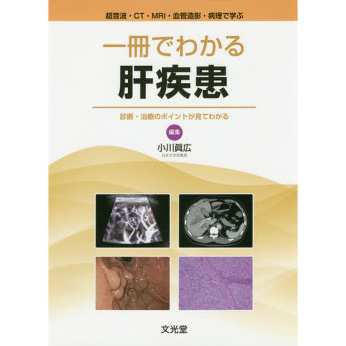 一冊でわかる肝疾患　超音波・ＣＴ・ＭＲＩ・血管造影・病理で学ぶ　診断・治療のポイントが見てわかる