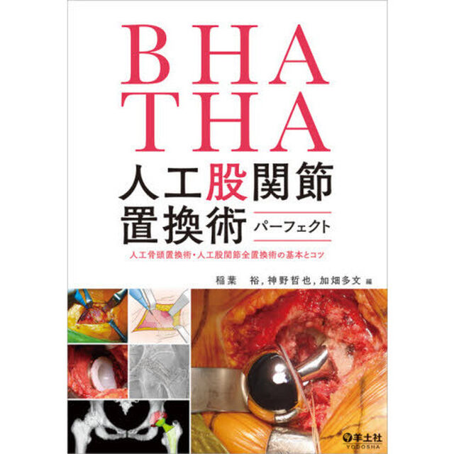 ＢＨＡ・ＴＨＡ人工股関節置換術パーフェクト　人工骨頭置換術・人工股関節全置換術の基本とコツ