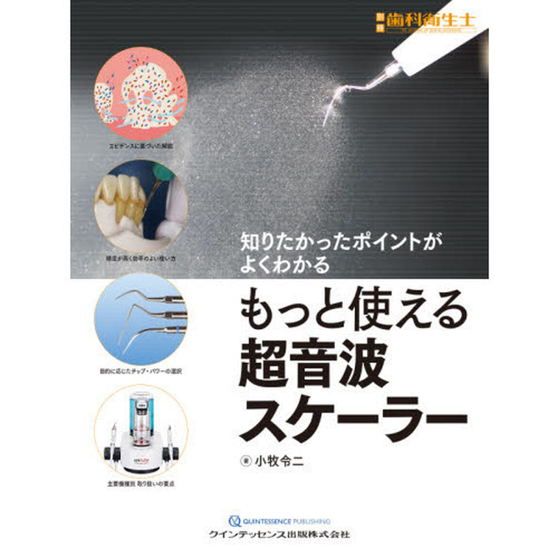 もっと使える超音波スケーラー　知りたかったポイントがよくわかる