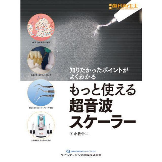 もっと使える超音波スケーラー　知りたかったポイントがよくわかる