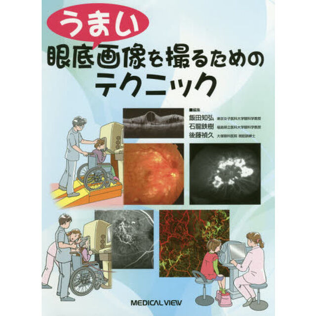 うまい眼底画像を撮るためのテクニック