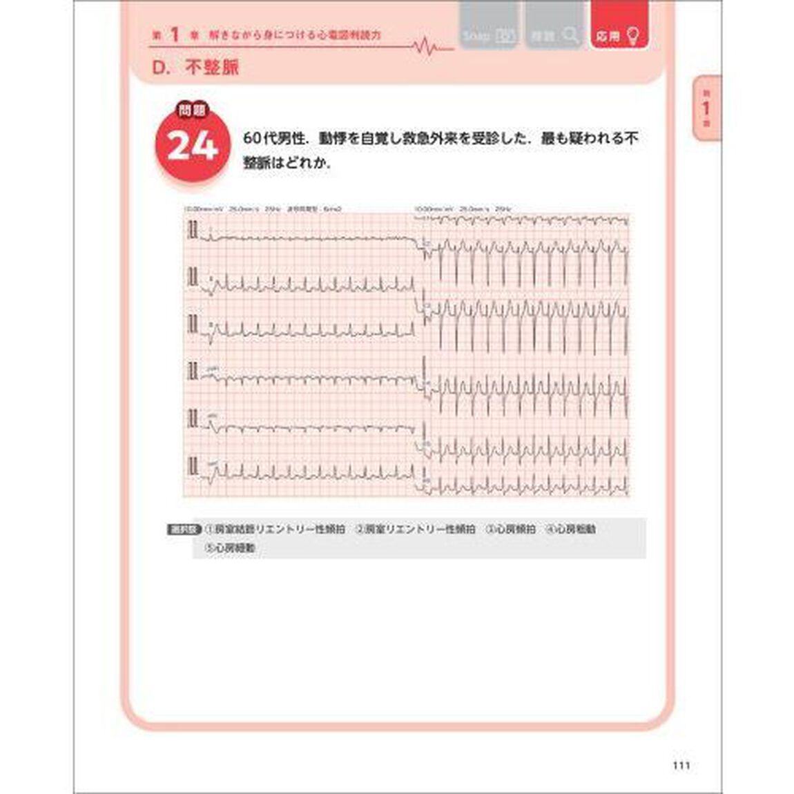 心電図完全攻略マニュアル　マイスターが教える１・２級合格への最強メソッド