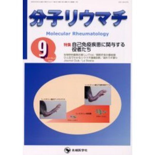 分子リウマチ　Ｖｏｌ．３Ｎｏ．３（２００６－９）「特集自己免疫疾患に関与する役者たち」