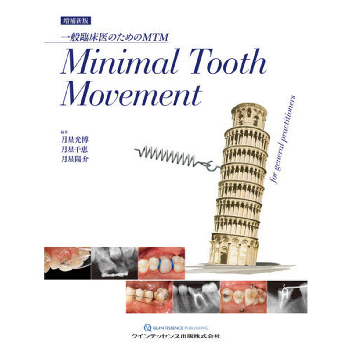 Ｍｉｎｉｍａｌ　Ｔｏｏｔｈ　Ｍｏｖｅｍｅｎｔ　一般臨床医のためのＭＴＭ「増補新版」