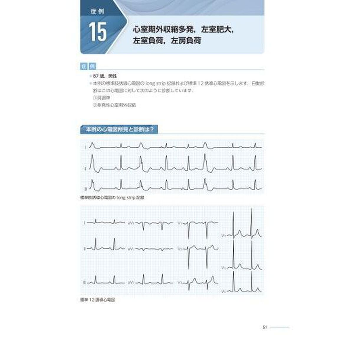 症例で学ぶ検診心電図集中セミナー