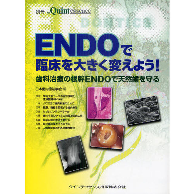 ＥＮＤＯで臨床を大きく変えよう！　歯科治療の根幹ＥＮＤＯで天然歯を守る