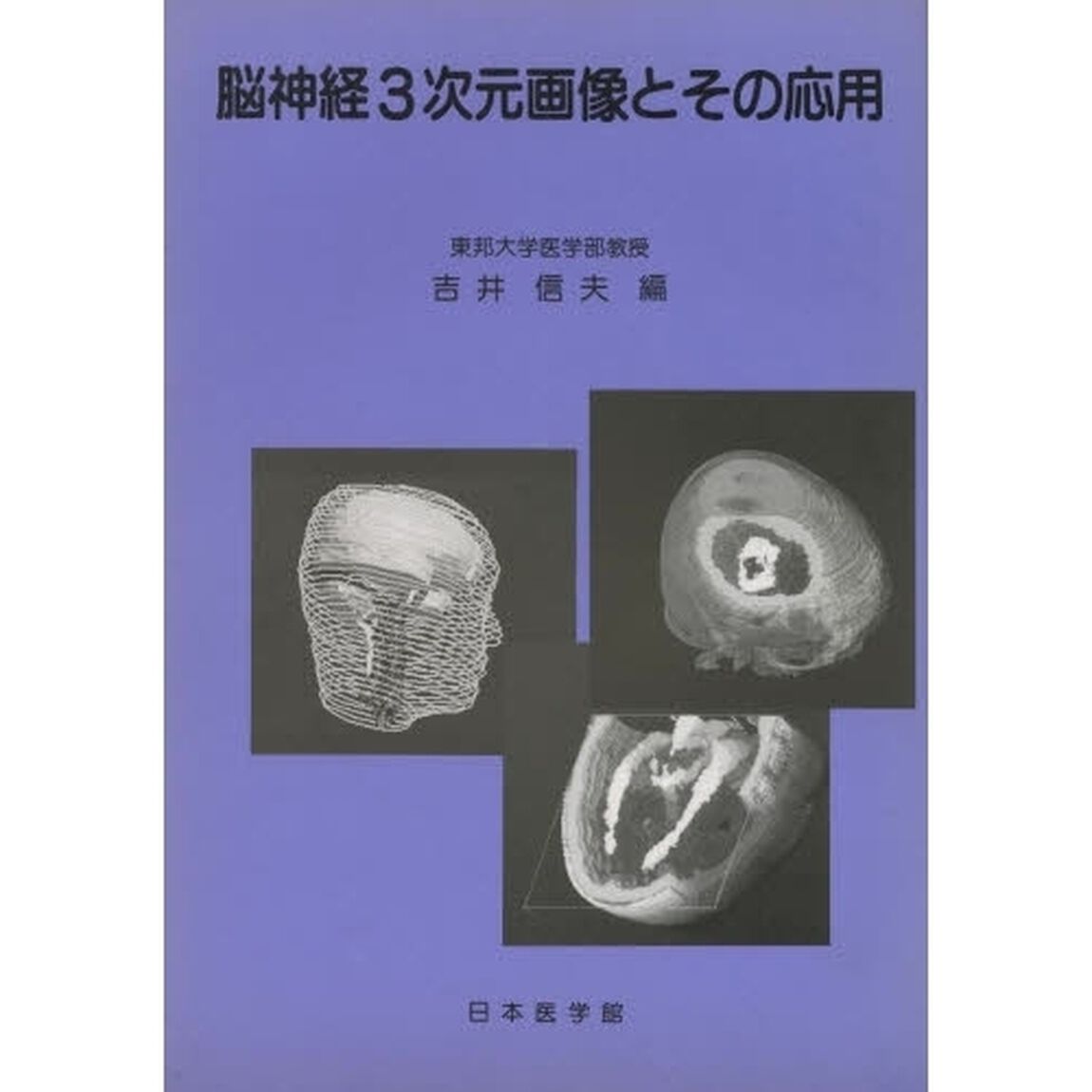 脳神経３次元画像とその応用